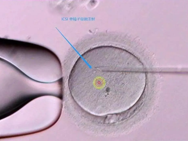 20个胚胎能移植几次要分情况，这几个因素影响成功率